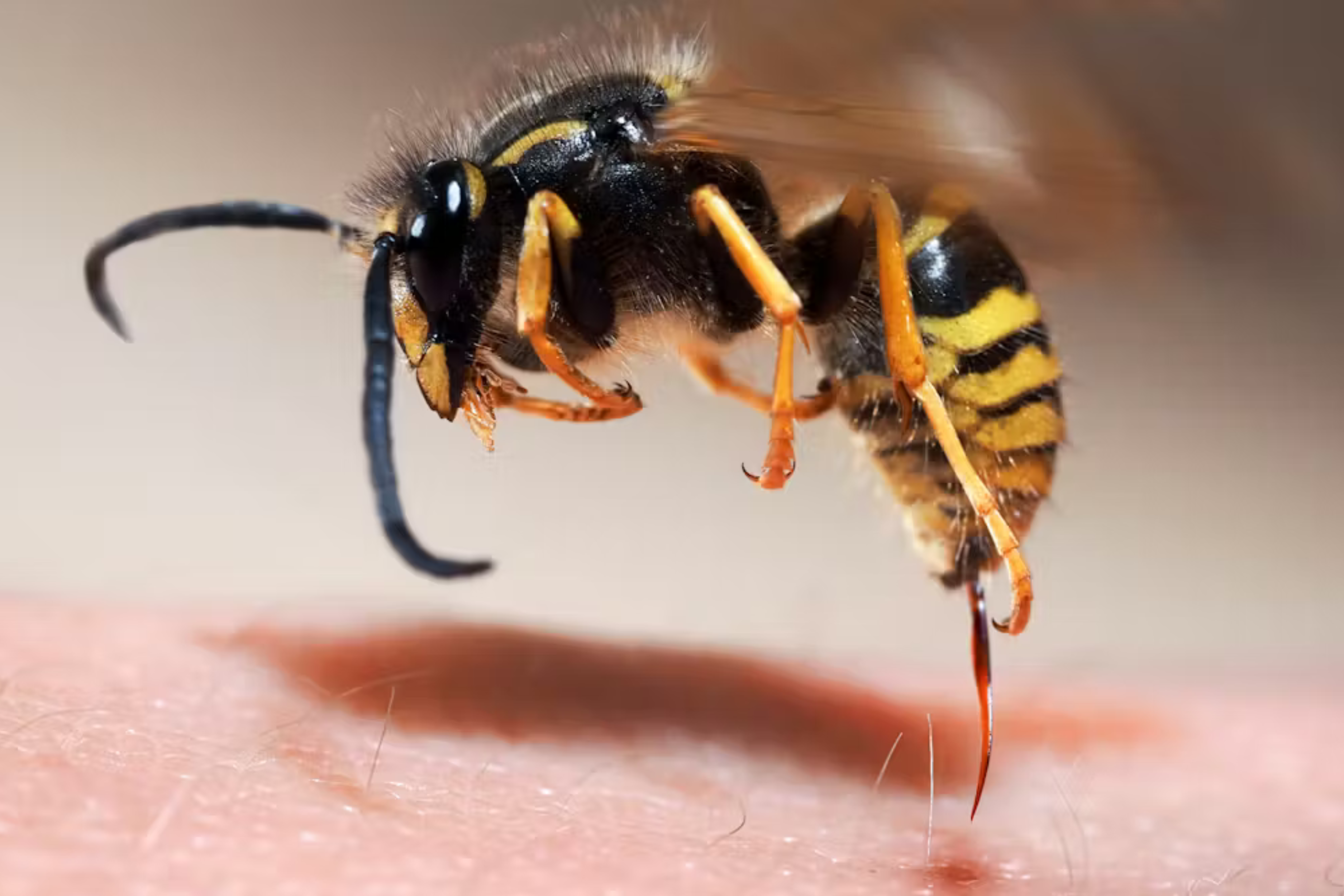 Insectes à dard : prévention, piqûres et bons réflexes